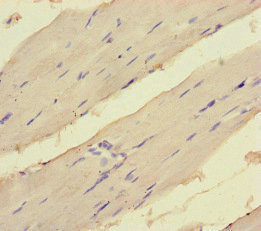 EEF1A1 Antibody - Immunohistochemistry of paraffin-embedded human skeletal muscle tissue at dilution of 1:100