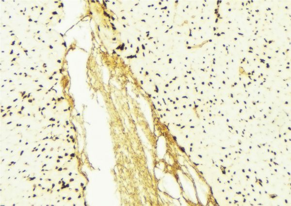 EEF1A1 Antibody - 1:100 staining mouse liver tissue by IHC-P. The sample was formaldehyde fixed and a heat mediated antigen retrieval step in citrate buffer was performed. The sample was then blocked and incubated with the antibody for 1.5 hours at 22°C. An HRP conjugated goat anti-rabbit antibody was used as the secondary.