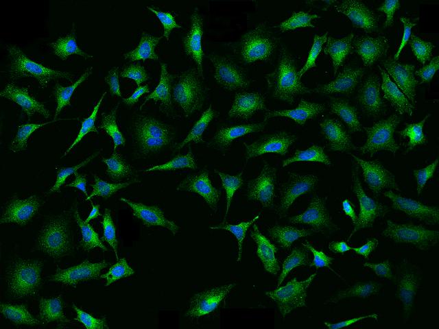 EEF1A1 Antibody - Immunofluorescence staining of EEF1A1 in HeLa cells. Cells were fixed with 4% PFA, permeabilzed with 0.1% Triton X-100 in PBS, blocked with 10% serum, and incubated with rabbit anti-Human EEF1A1 polyclonal antibody (dilution ratio 1:1000) at 4°C overnight. Then cells were stained with the Alexa Fluor 488-conjugated Goat Anti-rabbit IgG secondary antibody (green) and counterstained with DAPI (blue). Positive staining was localized to Cytoplasm.