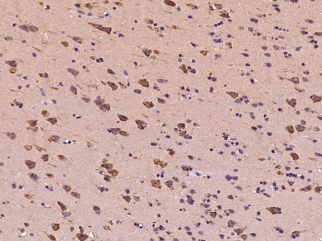 EEF1A1 Antibody - Immunochemical staining of human EEF1A1 in human brain with rabbit polyclonal antibody at 1:500 dilution, formalin-fixed paraffin embedded sections.