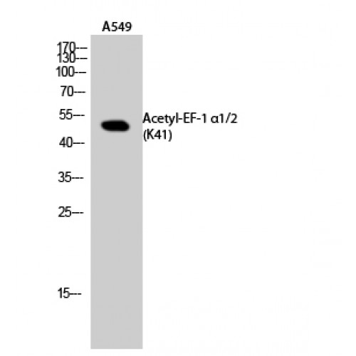 EEF1A1 + EEF1A2 Antibody - Western blot of Acetyl-EF-1 alpha1/2 (K41) antibody