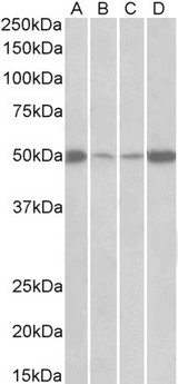 EEF1A2 Antibody - EEF1A2 antibody (0.5 ug/ml) staining of Mouse (A+C) and Rat (B+D) Skeletal Muscle (A+B) and Heart (C+D) lysates (35 ug protein in RIPA buffer). Primary incubation was 1 hour. Detected by chemiluminescence.