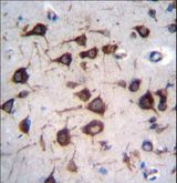 EEF1A2 Antibody - EEF1A2 Antibody immunohistochemistry of formalin-fixed and paraffin-embedded human brain tissue followed by peroxidase-conjugated secondary antibody and DAB staining.