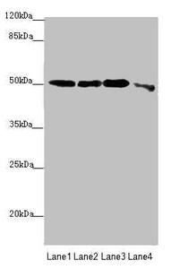 EEF1A2 Antibody - Western blot All Lanes: EEF1A2 antibody at 2.23 ug/ml Lane 1: MCF7 whole cell lysate Lane 2: Hela whole cell lysate Lane 3: Raji whole cell lysate Lane 4: HepG-2 whole cell lysate Secondary Goat polyclonal to rabbit IgG at 1/10000 dilution Predicted band size: 50 kDa Observed band size: 50 kDa