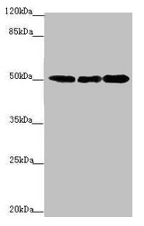 EEF1A2 Antibody - Western blot All lanes: EEF1A2 antibody at 2.23µg/ml Lane 1: MCF-7 whole cell lysate Lane 2: Hela whole cell lysate Lane 3: Raji whole cell lysate Secondary Goat polyclonal to rabbit IgG at 1/10000 dilution Predicted band size: 50 kDa Observed band size: 50 kDa
