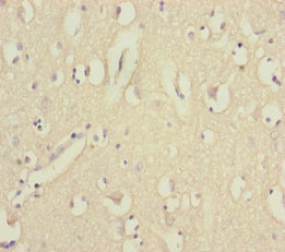EEF1A2 Antibody - Immunohistochemistry of paraffin-embedded human brain tissue at dilution of 1:100