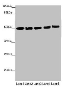 EEF1A2 Antibody - Western blot All Lanes: EEF1A2 antibody at 1.46 ug/ml Lane 1: MCF7 whole cell lysate Lane 2: Hela whole cell lysate Lane 3: Raji whole cell lysate Lane 4: HepG-2 whole cell lysate Lane 5: A431 whole cell lysate Secondary Goat polyclonal to rabbit IgG at 1/10000 dilution Predicted band size: 50 kDa Observed band size: 50 kDa