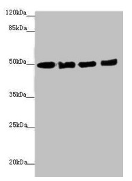 EEF1A2 Antibody - Western blot All lanes: EEF1A2 antibody at 1.46µg/ml Lane 1: MCF-7 whole cell lysate Lane 2: Hela whole cell lysate Lane 3: Raji whole cell lysate Lane 4: A431 whole cell lysate Secondary Goat polyclonal to rabbit IgG at 1/10000 dilution Predicted band size: 50 kDa Observed band size: 50 kDa