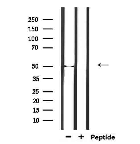 EEF1A2 Antibody - Western blot analysis of extracts of rat muscle using EEF1A2 antibody.
