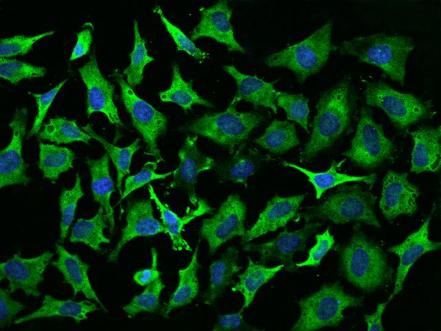 EEF1A2 Antibody - Immunofluorescence staining of EEF1A2 in Hela cells. Cells were fixed with 4% PFA, permeabilzed with 0.1% Triton X-100 in PBS, blocked with 10% serum, and incubated with rabbit anti-Human EEF1A2 polyclonal antibody (dilution ratio 1:200) at 4°C overnight. Then cells were stained with the Alexa Fluor 488-conjugated Goat Anti-rabbit IgG secondary antibody (green) and counterstained with DAPI (blue). Positive staining was localized to Cytoplasm.