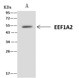 EEF1A2 Antibody - EEF1A2 was immunoprecipitated using: Lane A: 0.5 mg U-251MG Whole Cell Lysate. 4 uL anti-EEF1A2 rabbit polyclonal antibody and 60 ug of Immunomagnetic beads Protein A/G. Primary antibody: Anti-EEF1A2 rabbit polyclonal antibody, at 1:100 dilution. Secondary antibody: Clean-Blot IP Detection Reagent (HRP) at 1:1000 dilution. Developed using the ECL technique. Performed under reducing conditions. Predicted band size: 50 kDa. Observed band size: 50 kDa.