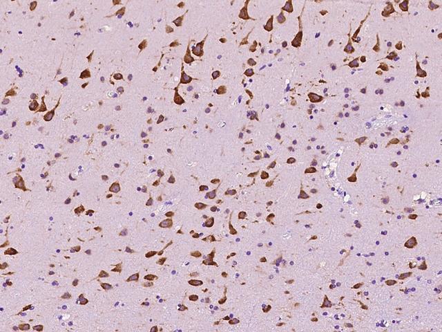 EEF1A2 Antibody - Immunochemical staining of human EEF1A2 in human brain with rabbit polyclonal antibody at 1:200 dilution, formalin-fixed paraffin embedded sections.