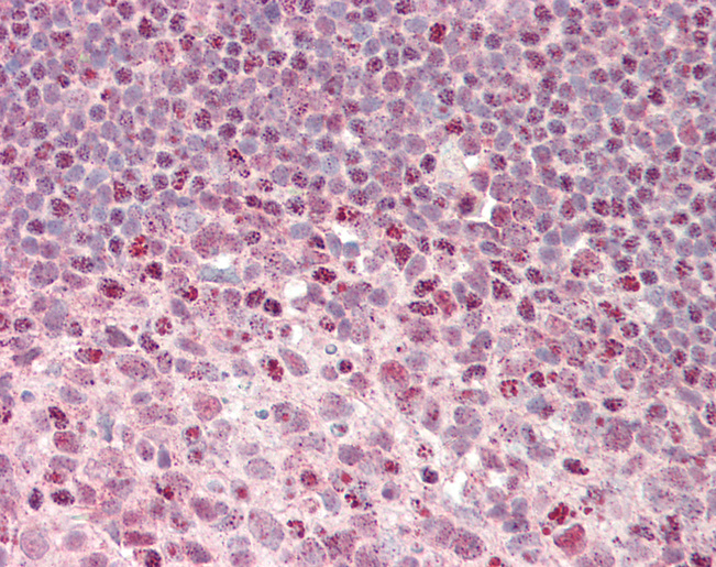 EEF1D Antibody - Human Tonsil: Formalin-Fixed, Paraffin-Embedded (FFPE).  This image was taken for the unconjugated form of this product. Other forms have not been tested.