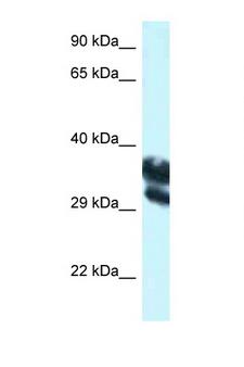 EEF1D Antibody - EEF1D antibody Western blot of HepG2 Cell lysate. Antibody concentration 1 ug/ml.  This image was taken for the unconjugated form of this product. Other forms have not been tested.