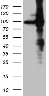 EEF1D Antibody - HEK293T cells were transfected with the pCMV6-ENTRY control. (Left lane) or pCMV6-ENTRY EEF1D. (Right lane) cDNA for 48 hrs and lysed