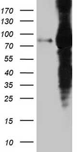 EEF1D Antibody - HEK293T cells were transfected with the pCMV6-ENTRY control. (Left lane) or pCMV6-ENTRY EEF1D. (Right lane) cDNA for 48 hrs and lysed. Equivalent amounts of cell lysates. (5 ug per lane) were separated by SDS-PAGE and immunoblotted with anti-EEF1D. (1:2000)