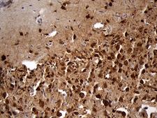 EEF1D Antibody - Immunohistochemical staining of paraffin-embedded Human adult brain tissue within the normal limits using anti-EEF1D mouse monoclonal antibody. (Heat-induced epitope retrieval by 1mM EDTA in 10mM Tris buffer. (pH8.5) at 120 oC for 3 min. (1:2000)