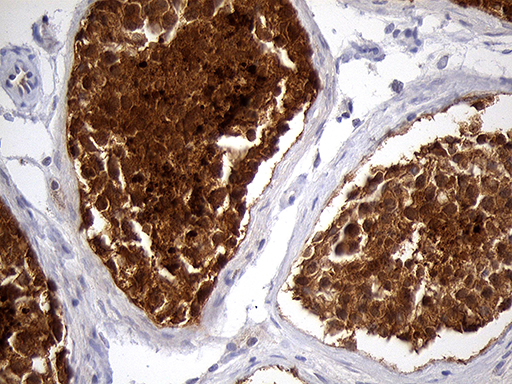 EEF1D Antibody - Immunohistochemical staining of paraffin-embedded Human testicle tissue within the normal limits using anti-EEF1D mouse monoclonal antibody. (Heat-induced epitope retrieval by 1mM EDTA in 10mM Tris buffer. (pH8.5) at 120°C for 3 min. (1:2000)