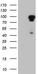 EEF1D Antibody - HEK293T cells were transfected with the pCMV6-ENTRY control. (Left lane) or pCMV6-ENTRY EEF1D. (Right lane) cDNA for 48 hrs and lysed. Equivalent amounts of cell lysates. (5 ug per lane) were separated by SDS-PAGE and immunoblotted with anti-EEF1D. (1:2000)