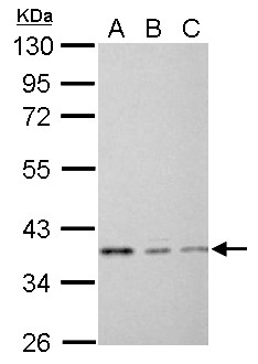 EEF1D Antibody - EEF1D antibody detects EEF1D protein by Western blot analysis.A. 30 ug THP-1 whole cell lysate/extract B. 30 ug HL-60 whole cell lysate/extract C. 30 ug NCI-H929 whole cell lysate/extract10 % SDS-PAGEEEF1D antibody  dilution: 1:1000