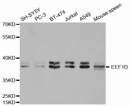 EEF1D Antibody - Western blot analysis of extracts of various cell lines.