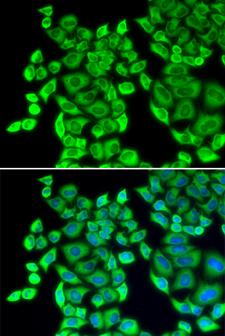 EEF1D Antibody - Immunofluorescence analysis of U20S cells.