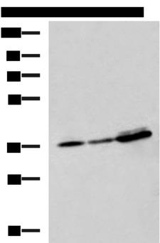 EEF1D Antibody - Western blot analysis of A549 A172 and HepG2 cell lysates  using EEF1D Polyclonal Antibody at dilution of 1:950