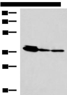 EEF1D Antibody - Western blot analysis of HepG2 A172 and A549 cell lysates  using EEF1D Polyclonal Antibody at dilution of 1:800