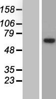 EEF1D Protein - Western validation with an anti-DDK antibody * L: Control HEK293 lysate R: Over-expression lysate
