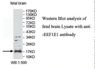 EEF1E1 / AIMP3 Antibody