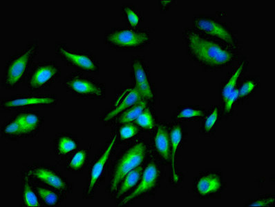 EEF1E1 / AIMP3 Antibody - Immunofluorescent analysis of Hela cells using EEF1E1 Antibody at dilution of 1:100 and Alexa Fluor 488-congugated AffiniPure Goat Anti-Rabbit IgG(H+L)