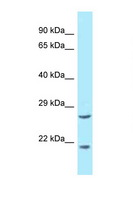 EEF1E1 / AIMP3 Antibody - EEF1E1 / AIMP3 / p18 antibody Western blot of 3 Cell lysate. Antibody concentration 1 ug/ml.  This image was taken for the unconjugated form of this product. Other forms have not been tested.