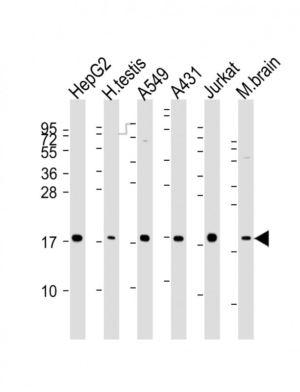 EEF1E1 / AIMP3 Antibody - All lanes : Anti-EEF1E1 Antibody at 1:2000-1:4000 dilution Lane 1: HepG2 whole cell lysates Lane 2: human testis lysates Lane 3: A549 whole cell lysates Lane 4: A431 whole cell lysates Lane 5: Jurkat whole cell lysates Lane 6: mouse brain lysates Lysates/proteins at 20 ug per lane. Secondary Goat Anti-Rabbit IgG, (H+L), Peroxidase conjugated at 1/10000 dilution Predicted band size : 20 kDa Blocking/Dilution buffer: 5% NFDM/TBST.