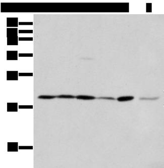 EEF1E1 / AIMP3 Antibody - Western blot analysis of 293T cell Hepg2 cell and A431 cell  using EEF1E1 Polyclonal Antibody at dilution of 1:400