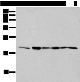 EEF1E1 / AIMP3 Antibody - Western blot analysis of 293T cell Human testis tissue Jurkat and A549 cell  using EEF1E1 Polyclonal Antibody at dilution of 1:300