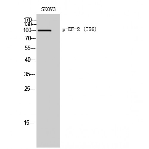 EEF2 / Elongation Factor 2 Antibody - Western blot of Phospho-EF-2 (T56) antibody
