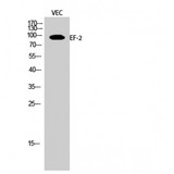EEF2 / Elongation Factor 2 Antibody - Western blot of EF-2 antibody