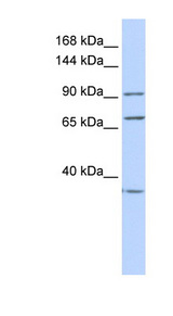 EEF2 / Elongation Factor 2 Antibody - EEF2 antibody Western blot of HeLa lysate. This image was taken for the unconjugated form of this product. Other forms have not been tested.