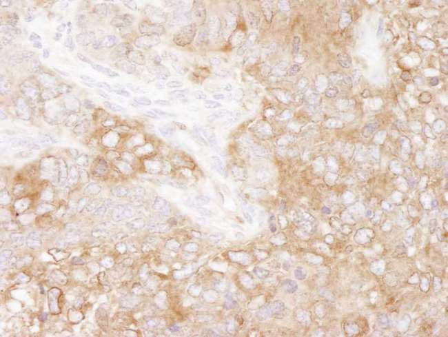 EEF2 / Elongation Factor 2 Antibody - Detection of Mouse eEF2 by Immunohistochemistry. Sample: FFPE section of mouse teratoma. Antibody: Affinity purified rabbit anti-eEF2 used at a dilution of 1:100.