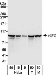 EEF2 / Elongation Factor 2 Antibody - Detection of Human and Mouse eEF2 by Western Blot. Samples: Whole cell lysate from HeLa (5, 15 and 50 ug), 293T (T; 50 ug), and mouse NIH3T3 (M; 50 ug) cells. Antibodies: Affinity purified rabbit anti-eEF2 antibody used for WB at 0.04 ug/ml. Detection: Chemiluminescence with an exposure time of 1 second.