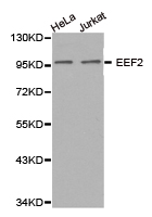 EEF2 / Elongation Factor 2 Antibody - Western blot of extracts of HeLa cell and Jurkat cell line, using EEF2 antibody.