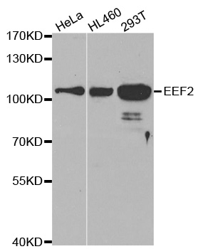 EEF2 / Elongation Factor 2 Antibody - Western blot analysis of extracts of various cell lines.