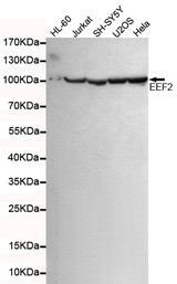 EEF2 / Elongation Factor 2 Antibody - Western blot detection of eEF2 in HL-60, Jurkat, SHSY-5Y, U20S and HeLa cell lysates using eEF2 mouse monoclonal antibody (1:5000 dilution). Predicted band size: 95KDa. Observed band size: 95KDa.Exposure time:15s.