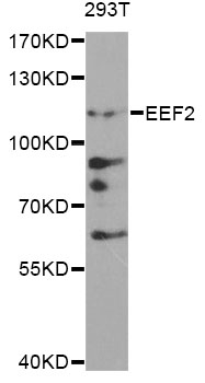 EEF2 / Elongation Factor 2 Antibody - Western blot analysis of extracts of 293T cells, using EEF2 antibody at 1:500 dilution. The secondary antibody used was an HRP Goat Anti-Rabbit IgG (H+L) at 1:10000 dilution. Lysates were loaded 25ug per lane and 3% nonfat dry milk in TBST was used for blocking.