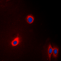 EEF2 / Elongation Factor 2 Antibody - Immunofluorescent analysis of EEF2 staining in A431 cells. Formalin-fixed cells were permeabilized with 0.1% Triton X-100 in TBS for 5-10 minutes and blocked with 3% BSA-PBS for 30 minutes at room temperature. Cells were probed with the primary antibody in 3% BSA-PBS and incubated overnight at 4 C in a humidified chamber. Cells were washed with PBST and incubated with a DyLight 594-conjugated secondary antibody (red) in PBS at room temperature in the dark. DAPI was used to stain the cell nuclei (blue).