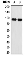 EEF2 / Elongation Factor 2 Antibody - Western blot analysis of EEF2 (pT56) expression in SKOV3 (A); NIH3T3 (B) whole cell lysates.