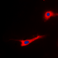 EEF2 / Elongation Factor 2 Antibody - Immunofluorescent analysis of EEF2 (pT56) staining in SKOV3 cells. Formalin-fixed cells were permeabilized with 0.1% Triton X-100 in TBS for 5-10 minutes and blocked with 3% BSA-PBS for 30 minutes at room temperature. Cells were probed with the primary antibody in 3% BSA-PBS and incubated overnight at 4 deg C in a humidified chamber. Cells were washed with PBST and incubated with a DyLight 594-conjugated secondary antibody (red) in PBS at room temperature in the dark. DAPI was used to stain the cell nuclei (blue).