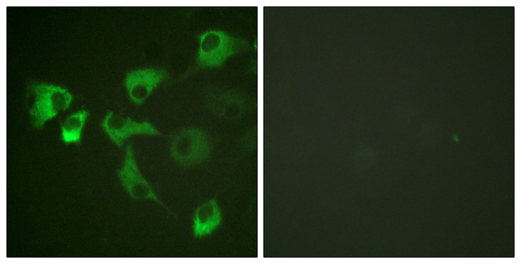EEF2 / Elongation Factor 2 Antibody - Immunofluorescence analysis of HUVEC cells, using eEF2 (Phospho-Thr56) Antibody. The picture on the right is blocked with the phospho peptide.
