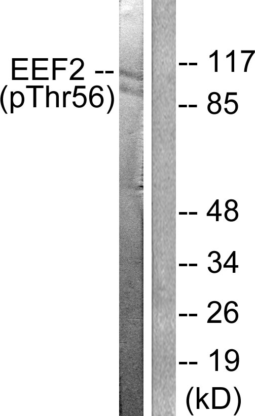 EEF2 / Elongation Factor 2 Antibody - Western blot analysis of lysates from NIH/3T3 cells treated with Serum 10% 30', using eEF2 (Phospho-Thr56) Antibody. The lane on the right is blocked with the phospho peptide.