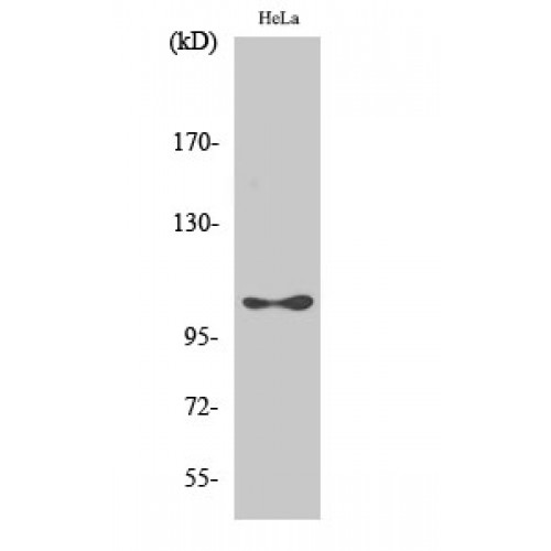 EEF2K Antibody - Western blot of Phospho-eEF2K (S366) antibody
